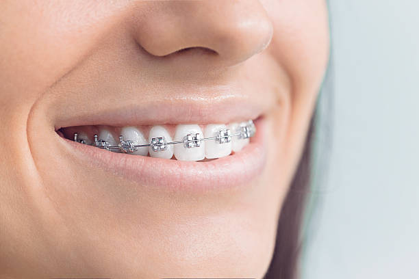 Best Dental Fillings (Composite and Amalgam)  in Island Lake, IL